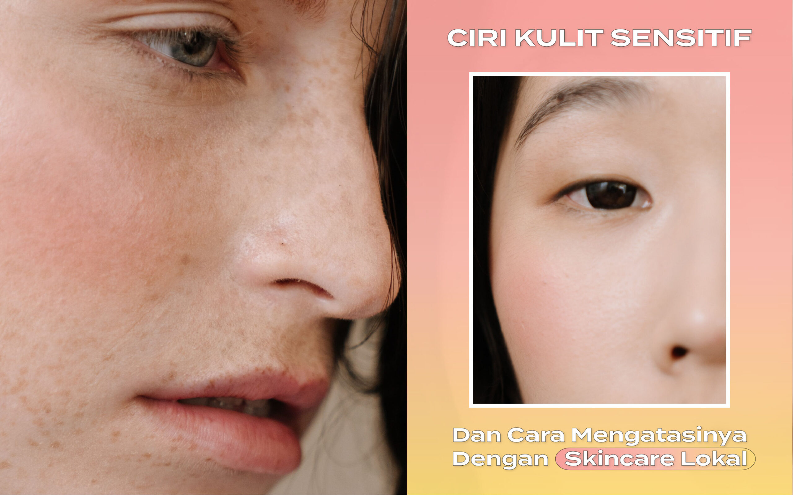 Ciri-Ciri Kulit Sensitif dan Cara Mengatasinya dengan Skincare