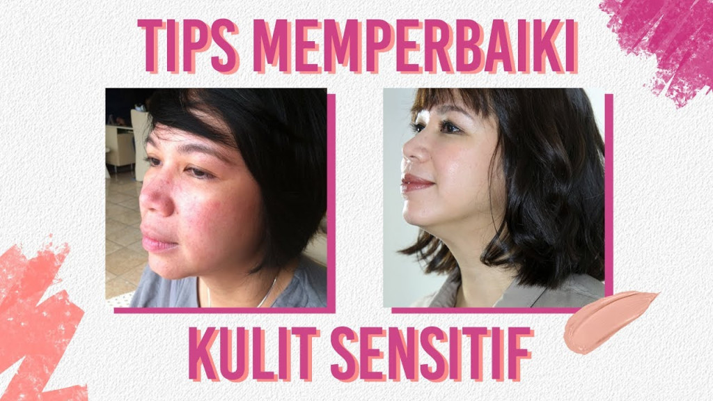 Mengenal Kulit Sensitif, Penyebab & Cara Mengatasinya