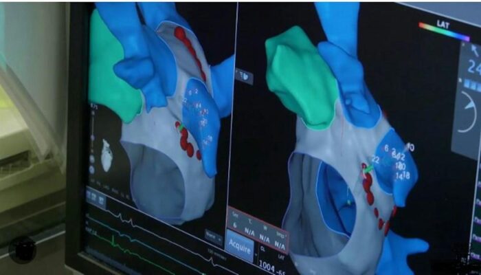 Bagaimana AI Meningkatkan Akurasi Diagnosis Dan Pengobatan