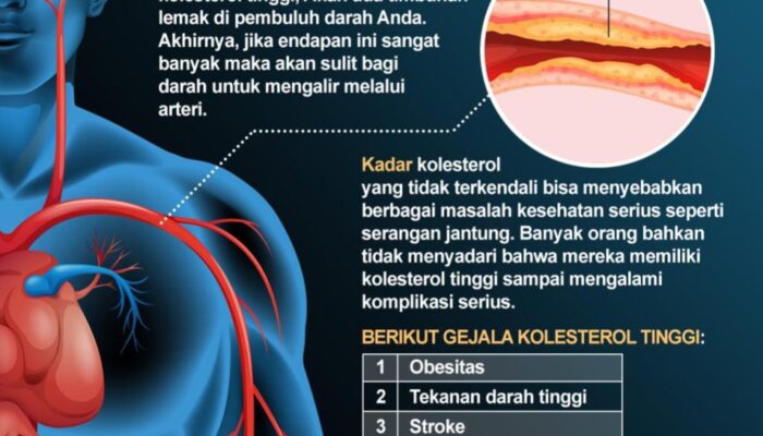 Gejala Kolesterol Tinggi Yang Sering Diabaikan