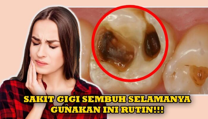 Mengatasi Nyeri Gigi Dengan Bahan Alami