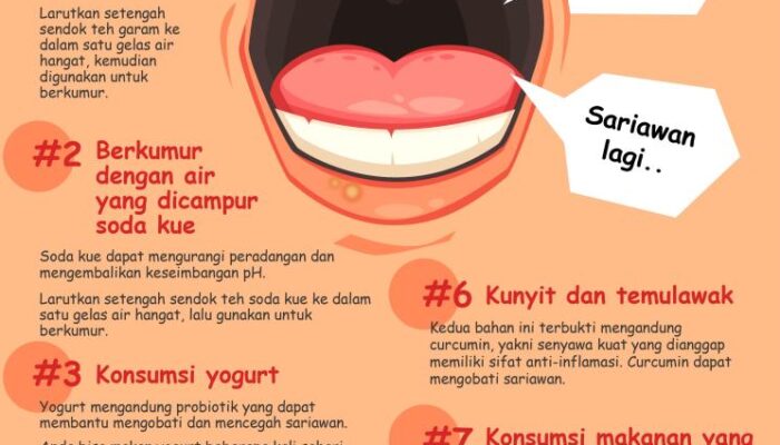 Teknik Mengatasi Masalah Sariawan